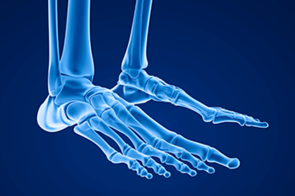 Understanding Fifth Metatarsal Fractures