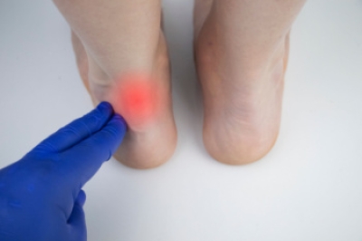 Treatment for Achilles Tendinopathy